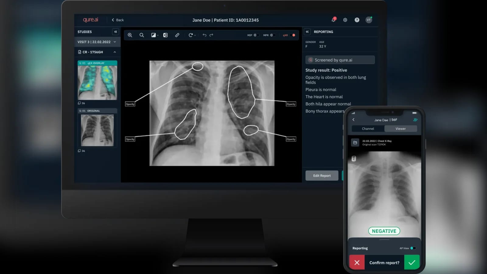 FDA Grants Aidoc Radiology AI Breakthrough Status
